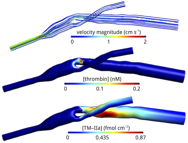 Occluded femoral artery